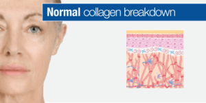 SkinDNA Genetic test 1